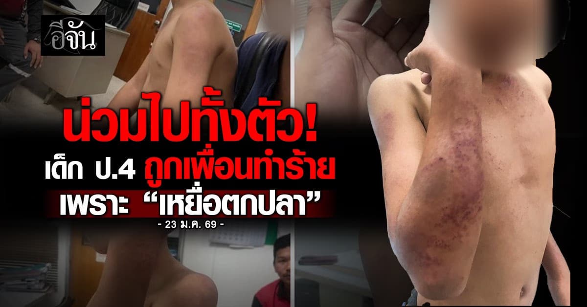 ฝันร้ายในโรงเรียน เด็ก ป.4 ถูกเพื่อนซ้อมโหดช้ำทั้งตัว เหตุเพราะ “เหยื่อตกปลา”