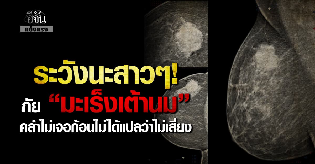 ระวังนะสาวๆ! ภัยของ “มะเร็งเต้านม” คลำไม่เจอก้อนไม่ได้แปลว่าไม่เสี่ยง