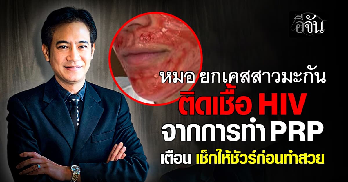 หมอ ยกเคสสาวมะกัน ติดเชื้อ HIV จากการทำ PRP เตือน เช็กให้ชัวร์ก่อนทำสวย 