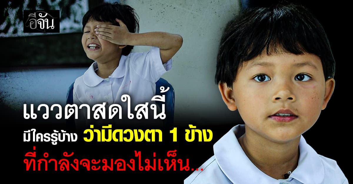 สุดเวทนาหนูน้อย “น้องดาด้า” กับดวงตาที่กำลังจะมองไม่เห็น