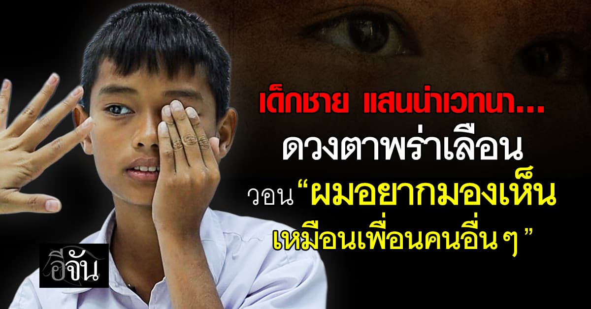 เวทนา เด็กชาย 10 ขวบ “ตาเป็นต้อ” กำลังจะพาชีวิตของเขา มืดลงทุกที…