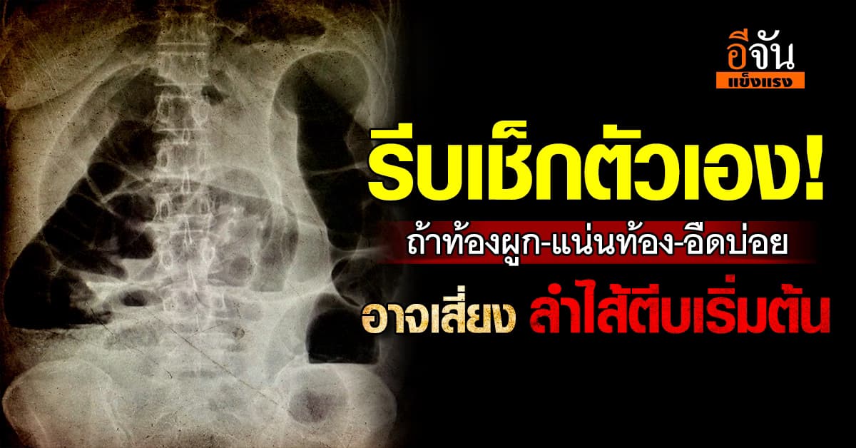 เตือนภัยโรค! ถ้าท้องผูก-แน่นท้อง-อืดบ่อย อาจเสี่ยง ลำไส้ตีบระยะเริ่มต้น 