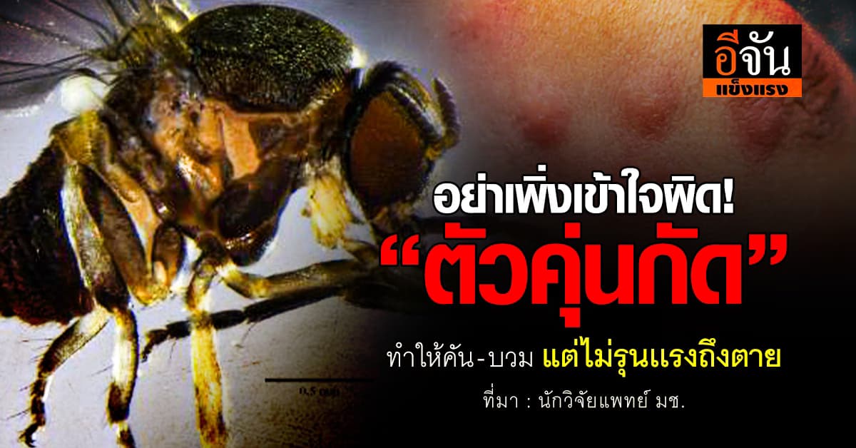 อย่าเพิ่งเข้าใจผิด! “ตัวคุ่นกัด” ไม่รุนเเรงถึงตาย 