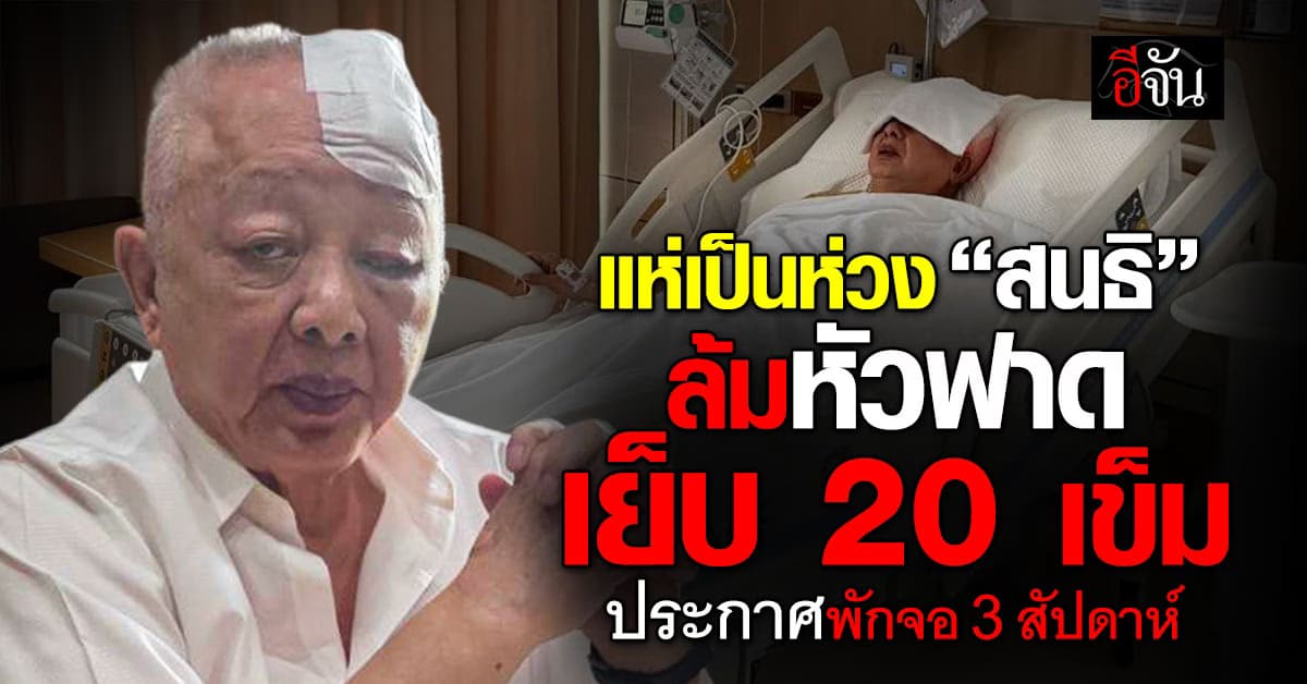 แฟนๆ แห่เป็นห่วง “สนธิ” ล้มหัวฟาดเย็บ 20 เข็ม ประกาศพักจอ 3 สัปดาห์  