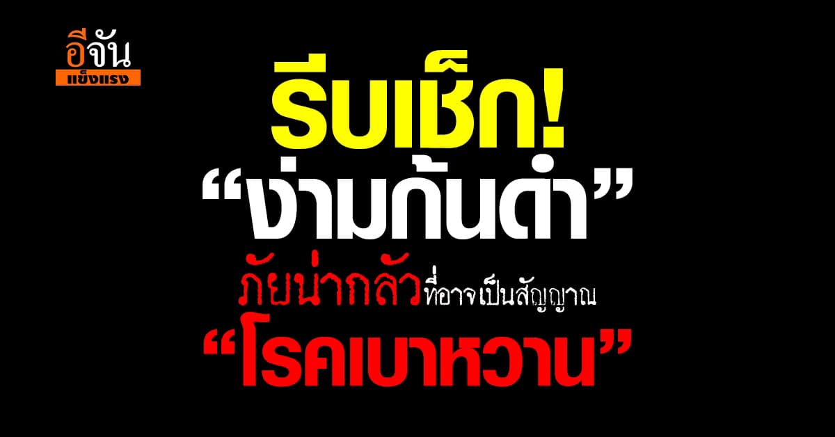 รีบเช็กเลยค่ะ! “ง่ามก้นดำ” อาจเป็นสัญญาณของ “โรคเบาหวาน” 