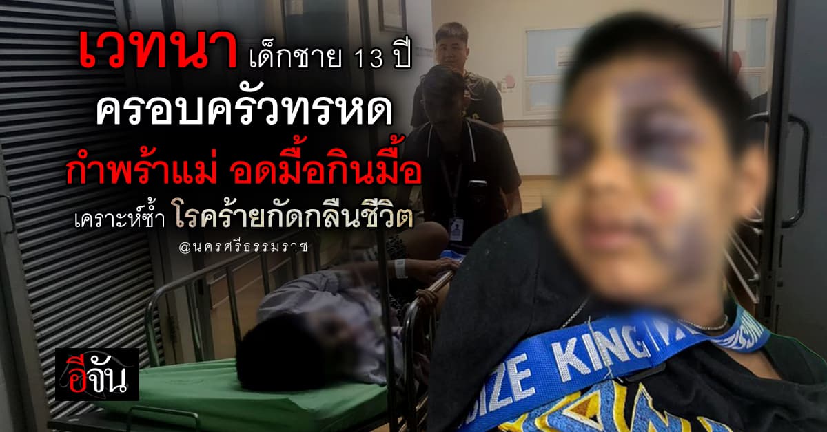 แสนเวทนา…เด็กชาย 13 ปี ประสบอุบัติเหตุหนัก เจ้าหน้าที่เข้าช่วยเหลือ ได้เห็นชีวิตแสนทรหด ต้องอดมื้อกินมื้อ