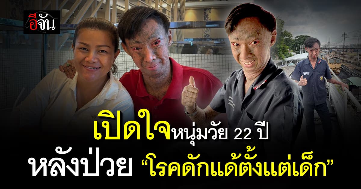 เปิดใจเด็กดักแด้ ตัวอย่างแรงใจให้คนที่กำลังท้อ 