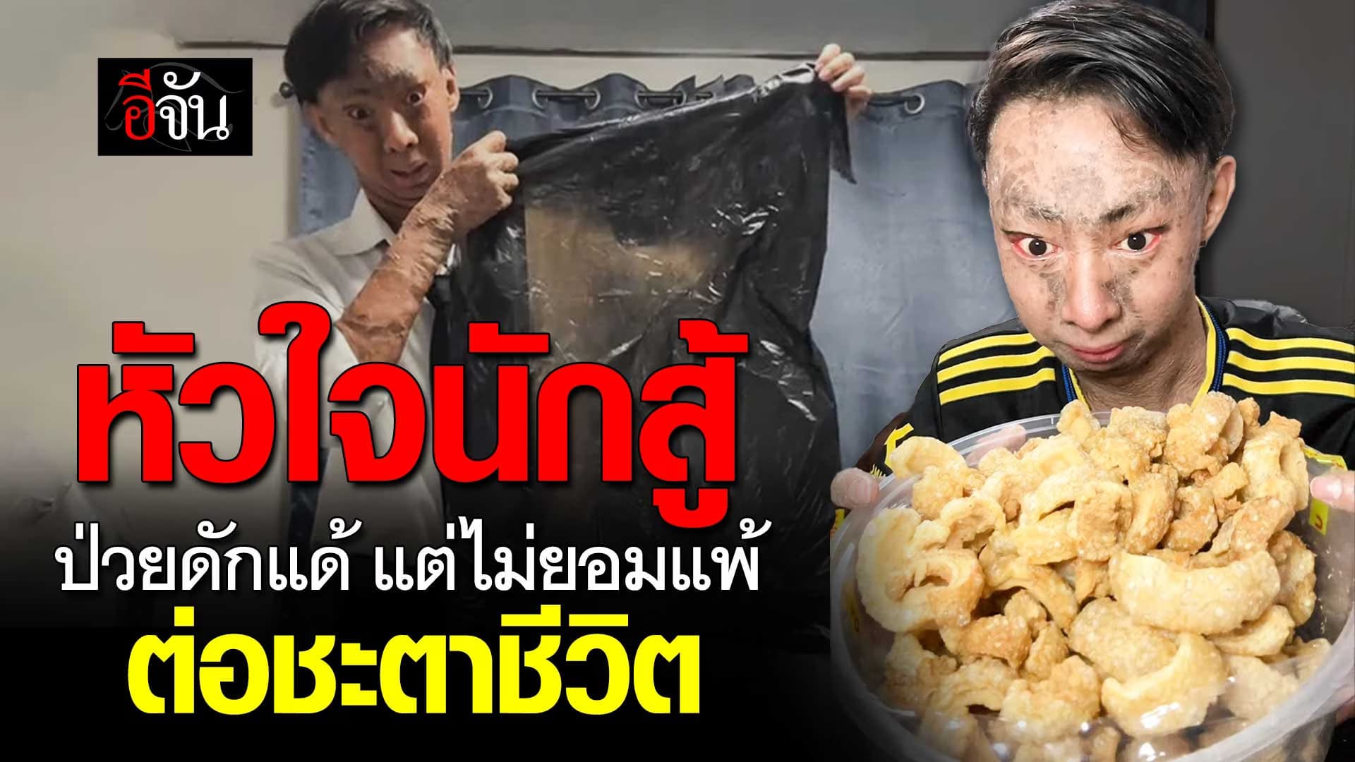 🎬 ชีวิตที่เลือกเกิดไม่ได้… “ยูฟ่า” เด็กดักแด้สู้ชีวิต