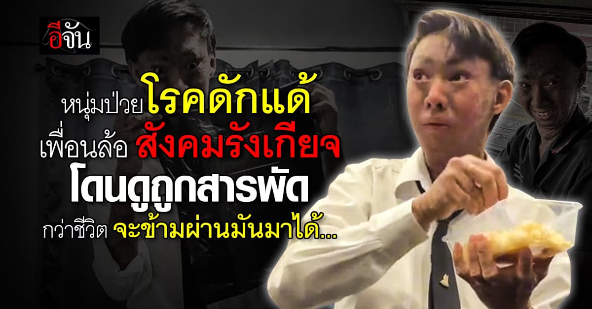 นับถือหัวใจ! “ยูฟ่า” ผู้ป่วยโรคดักแด้หัวใจแกร่ง ไลฟ์สดหาเงินส่งตัวเองเรียน กับวันที่ต้องก้าวข้ามคำบูลลี่