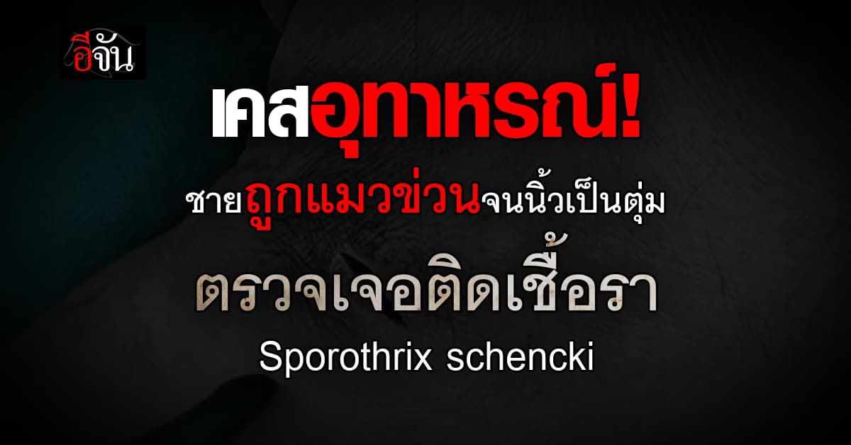 เคสอุทาหรณ์! ชายถูกแมวข่วนจนโคนนิ้วเป็นตุ่ม ติดเชื้อรา Sporothrix schencki 