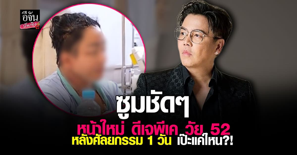 ฮือฮามากกก!  เปิดภาพแรก พีเค ปิยะวัฒน์ วัย 52 หลังศัลยกรรมหน้า 1 วัน