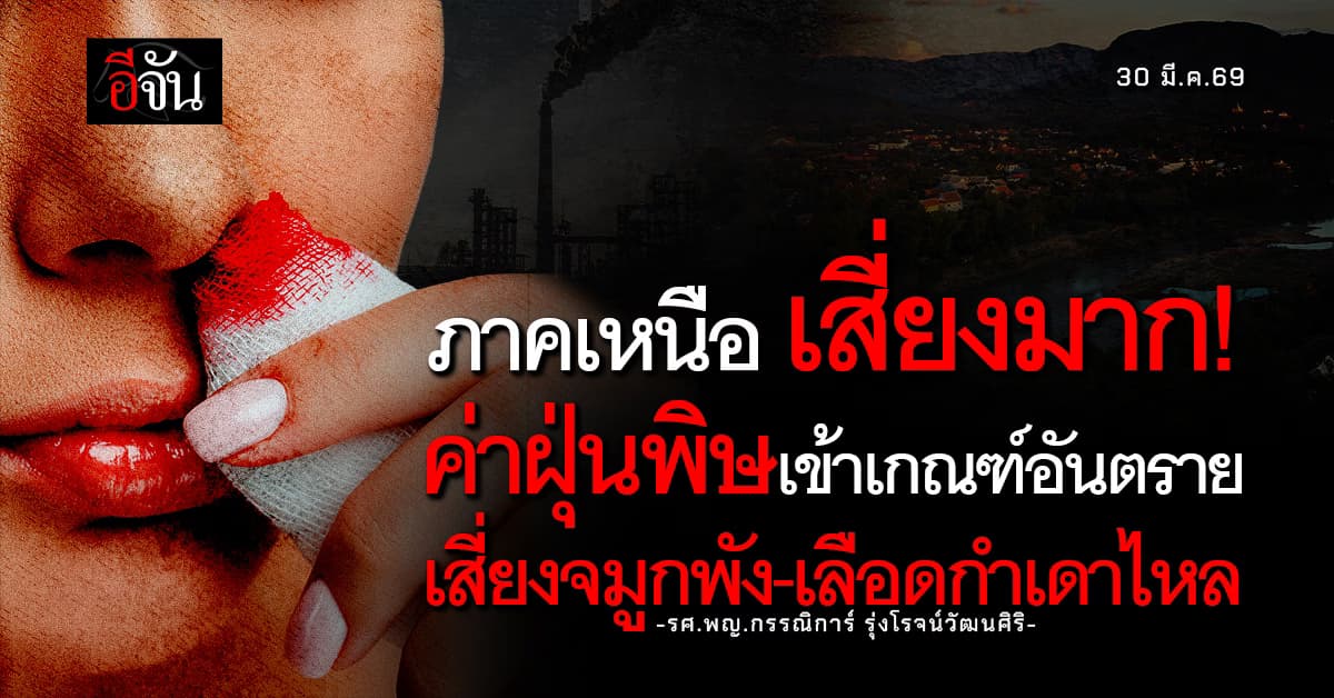 ภาคเหนือ เสี่ยงมาก! ค่าฝุ่นพิษเข้าเกณฑ์อันตราย แพทย์ มช. เตือนระวัง ภูมิแพ้กำเริบ-เลือดกำเดาไหล 