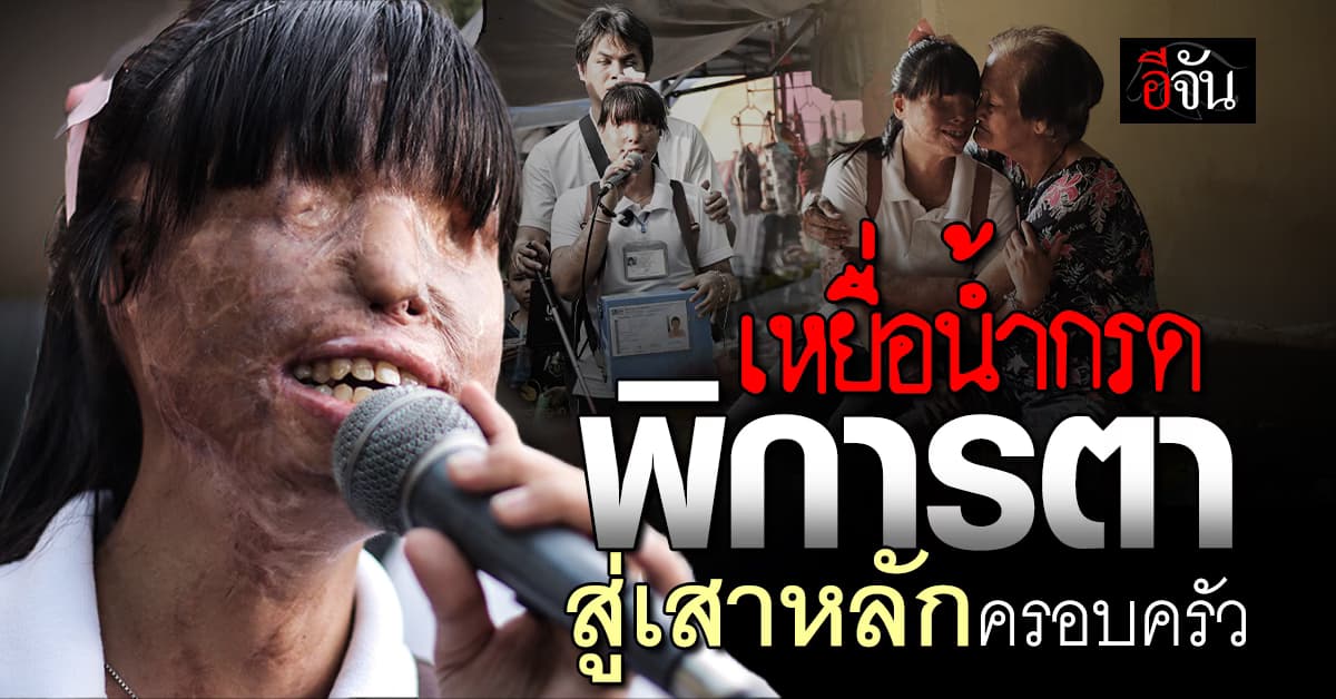 นุช เหยื่อสาดน้ำกรด พิการตา สู้ชีวิตจนกลายเป็นเสาหลักครอบครัว