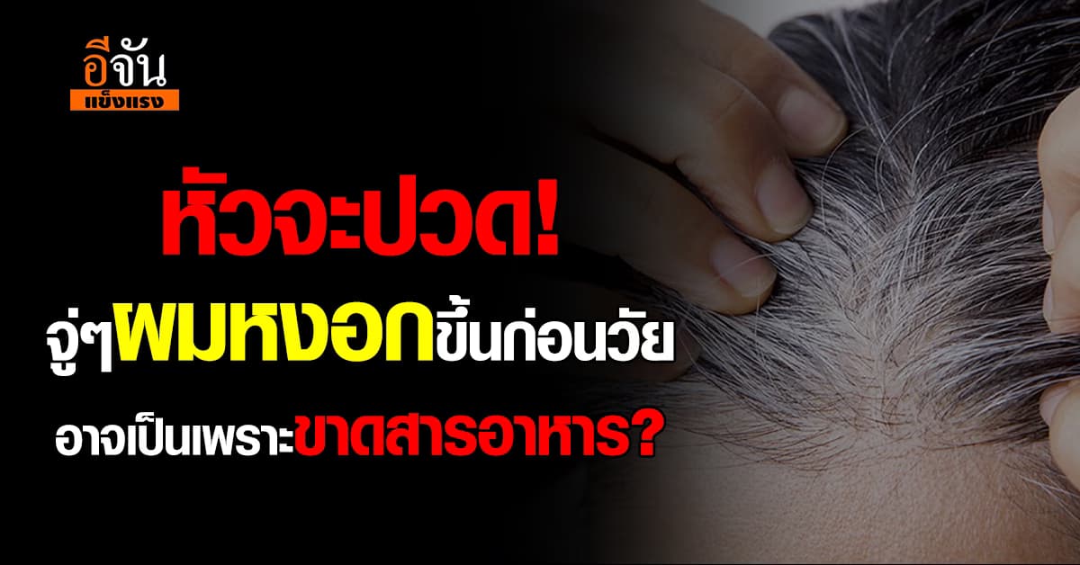 ผมหงอกขึ้นก่อนวัย! เหตุอาจมาจาก “การขาดสารอาหาร” ทำให้เส้นผมไม่ดำเงางาม  