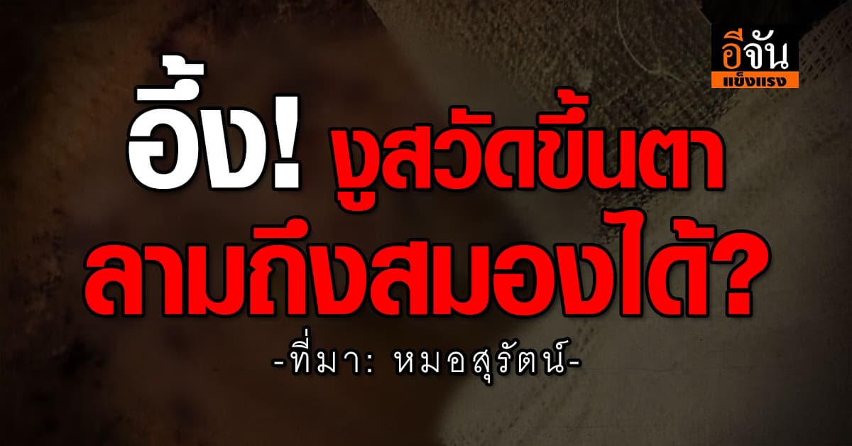 เเชร์เคสเตือนภัย! งูสวัดขึ้นตา ลามถึงสมอง เสี่ยงเกิดเเผลเเละตาบอดได้  