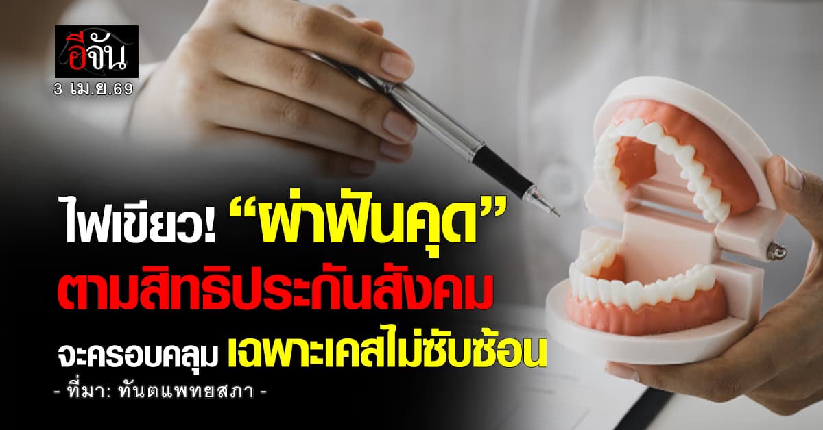 เช็กเงื่อนไข! สิทธิประกันสังคม ผ่าฟันคุดได้ เเต่ต้องเป็นเคสไม่ซับซ้อน 