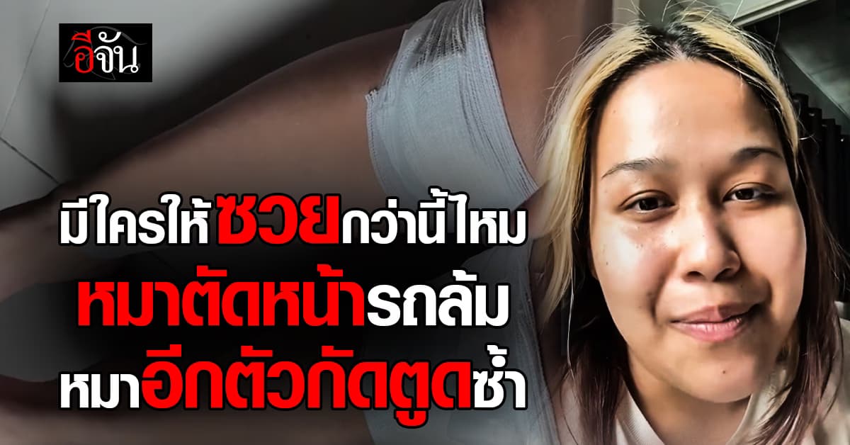 สาว แชร์ประสบการณ์ ซวยแบบ 2 In 1 รถล้มไม่พอ โดนหมากัดอีก