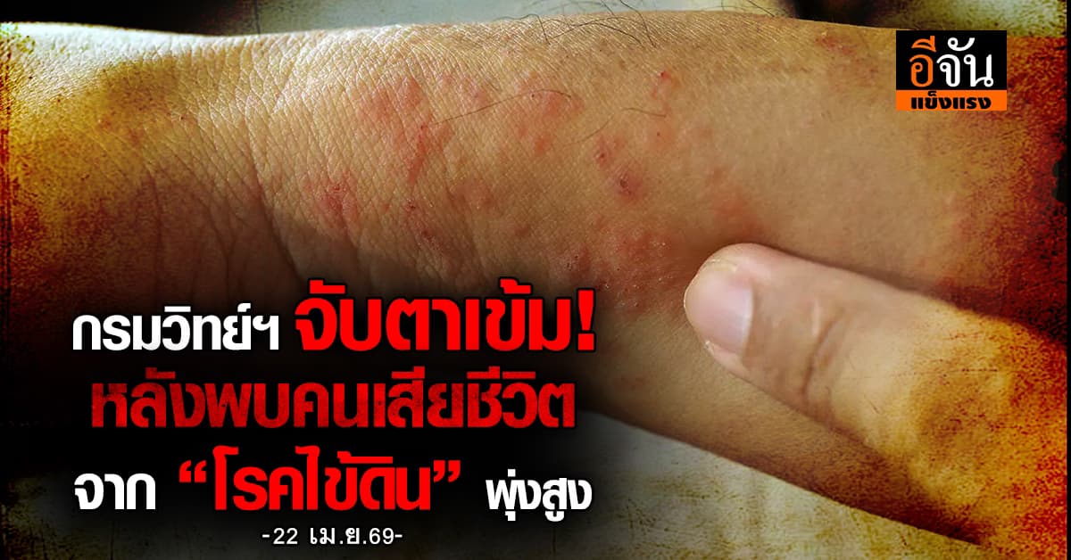 “โรคไข้ดิน” ยอดติดเชื้อพุ่งแรง กรมวิทย์ฯ สั่งจับตาเข้มหลังพบผู้เสียชีวิต 