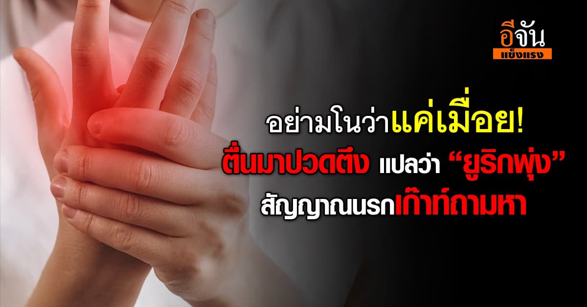 อย่ามโนว่าแค่เมื่อย! ตื่นมาปวดตึงคือ “ยูริกพุ่ง” สัญญาณนรกเก๊าท์ถามหา   