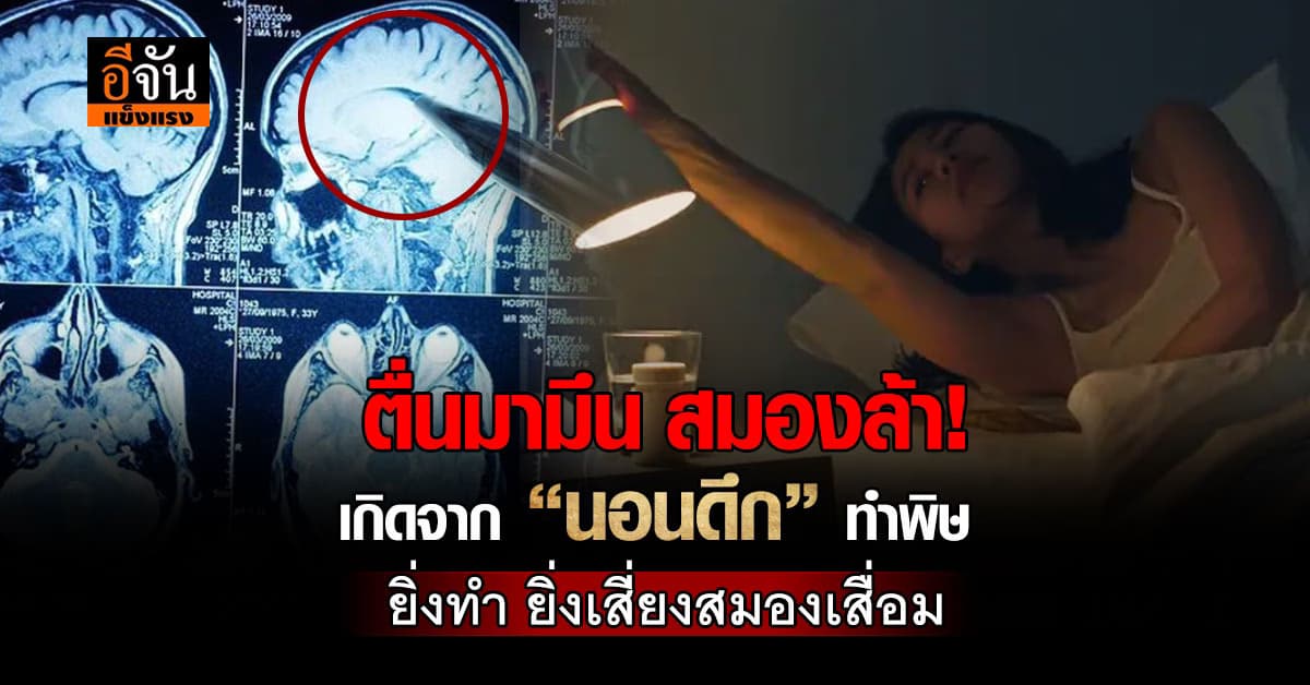 หยุดทำร้ายสมอง! นอนดึก ไม่ดีต่อร่างกายเสี่ยงสมองพัง  