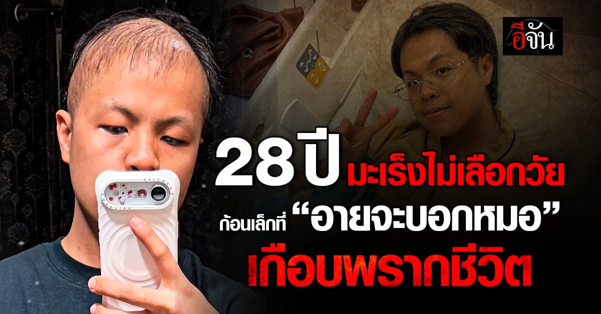 มะเร็งไม่เลือกวัย! จากความอาย…สู่มะเร็งระยะ 2 ของชายวัย 28