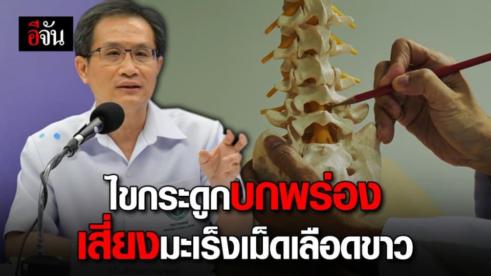 ไขกระดูกบกพร่องน่ากลัว! ระวังเป็นมะเร็งเม็ดเลือดขาวเฉียบพลัน