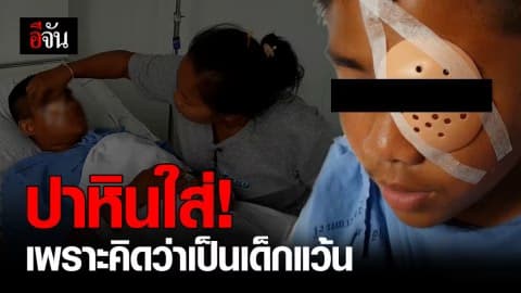 ตร.บ้าน ปาหินใส่เด็ก ม.3 เสี่ยงตาบอด เพราะคิดว่าเป็นเด็กแว้น