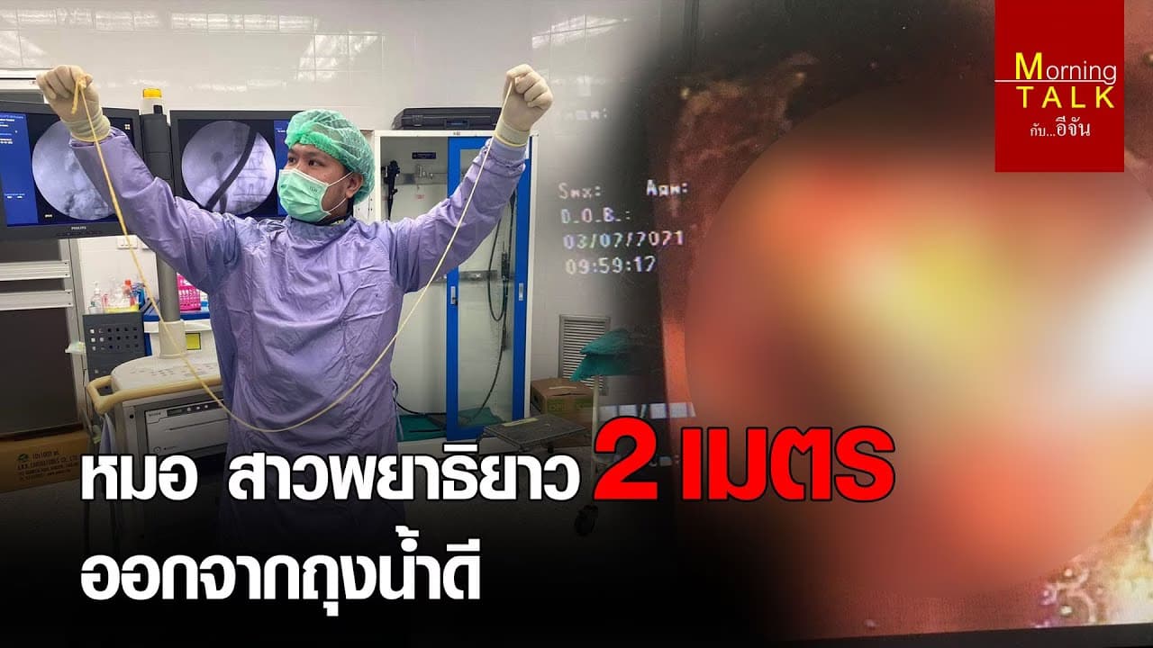 หมอ สาวพยาธิยาว 2 เมตร-ออกจากถุงน้ำดี