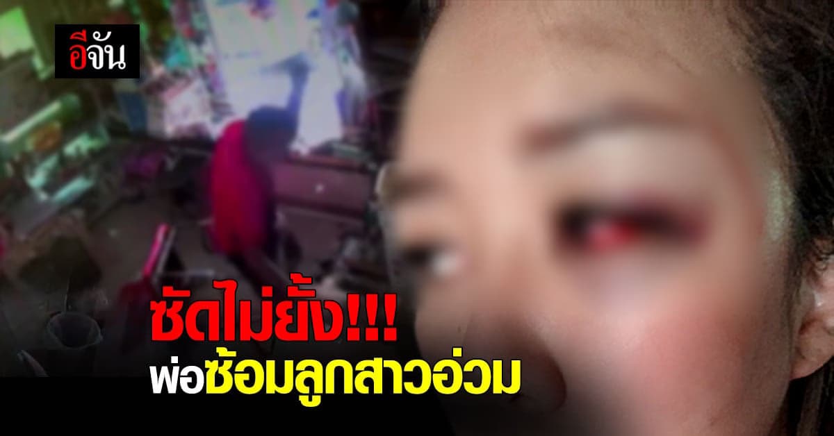 ลูกสาวสุดทน ร้องอีจัน ถูกพ่อแท้ๆ ใช้ด้ามดันรองเท้าซ้อม จนน่วม