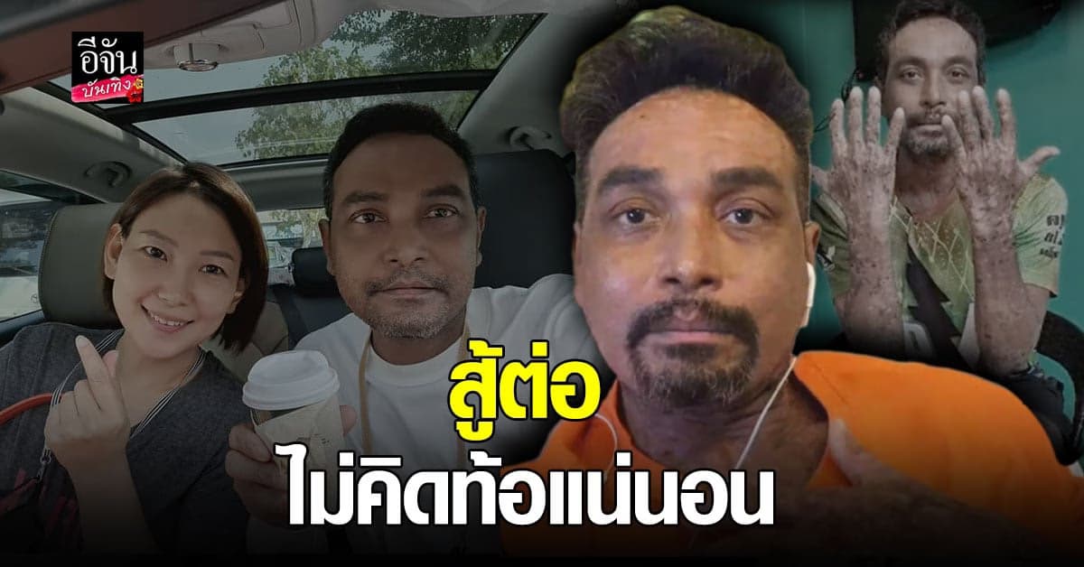 เปิดใจ เมฆ วินัย อัปเดตอาการ ตุ่มน้ำพอง ยันไม่ขอรับ เงินบริจาค เชื่อ ยังหาเองได้