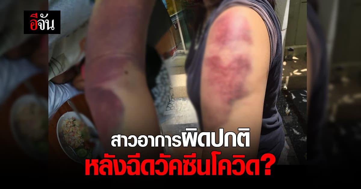 สาวมีอาการผิดปกติ หลังฉีดวัคซีนโควิด ไม่กี่วัน