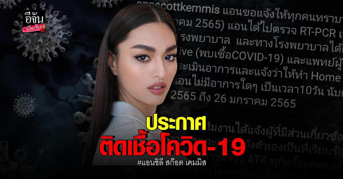 แอนชิลี สก๊อต เคมมิส แจ้งผลตรวจพบ ติดเชื้อโควิด 19