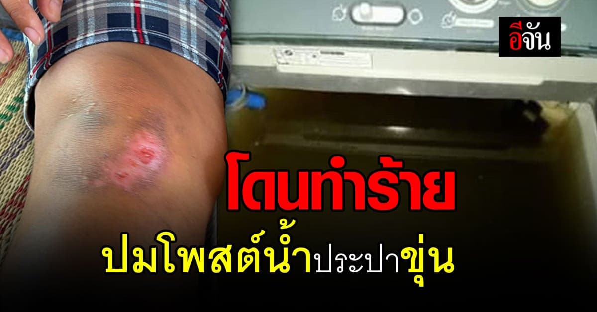 สาวร้อง! ถูก สมาชิก อบต. ทำร้ายหลังโพสต์ น้ำประปาขุ่น