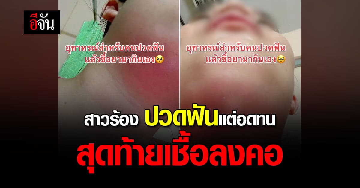 สาวโอด ทรมานที่สุดในชีวิต ปวดฟัน คิดว่าไม่เป็นอะไรสุดท้าย ติดเชื้อ