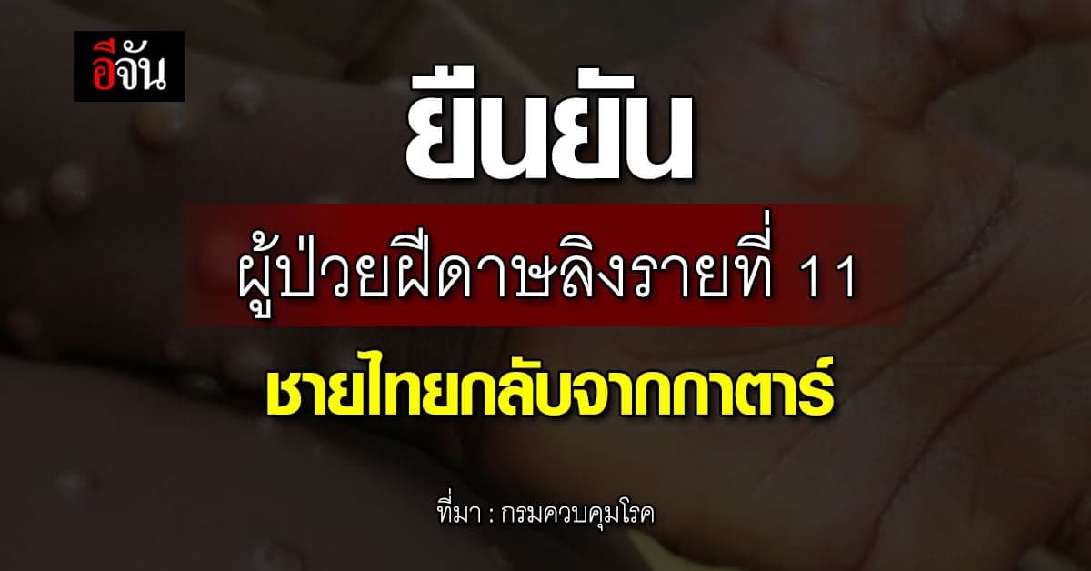 ผู้ป่วยฝีดาษลิงรายที่ 11 ชายไทยกลับจากกาตาร์