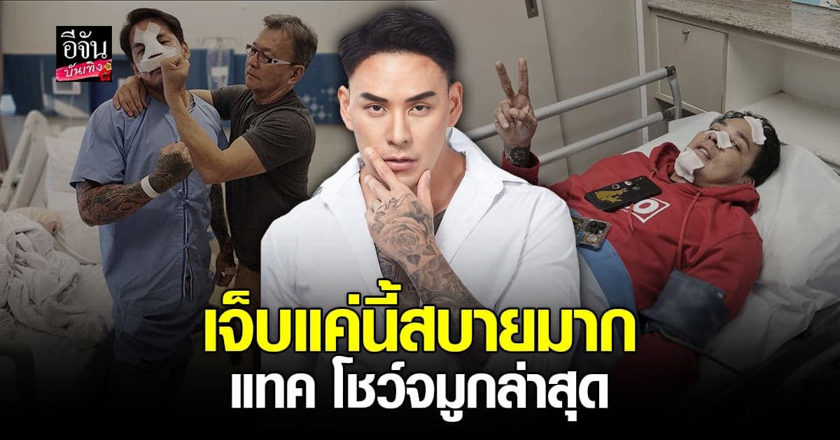 แทค ภรัณยู กำลังใจดี อัปเดตจมูกหลังผ่าตัด บอก เดี๋ยวก็เฟี้ยวแล้ว