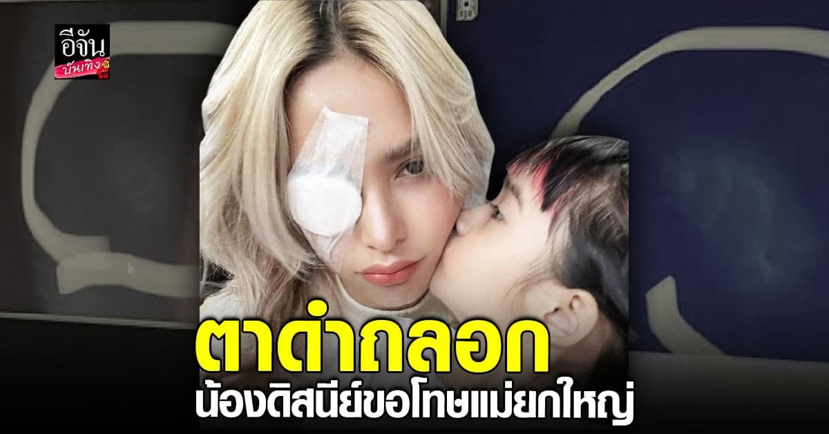 อุ้ม ลักขณา ตาดำถลอก หลัง น้องดิสนีย์ เผลอจิ้มตา