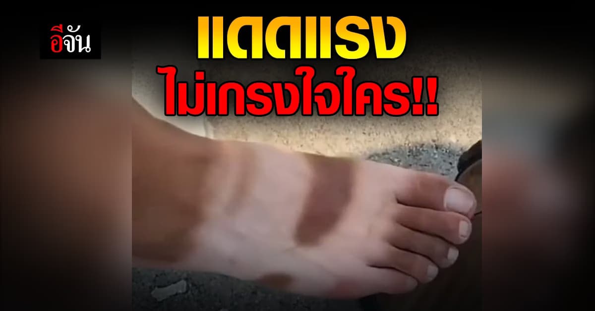 กรี๊ด ก็รู้ว่าแดดแรง แต่ไม่คิดว่าจะแรงได้ขนาดนี้