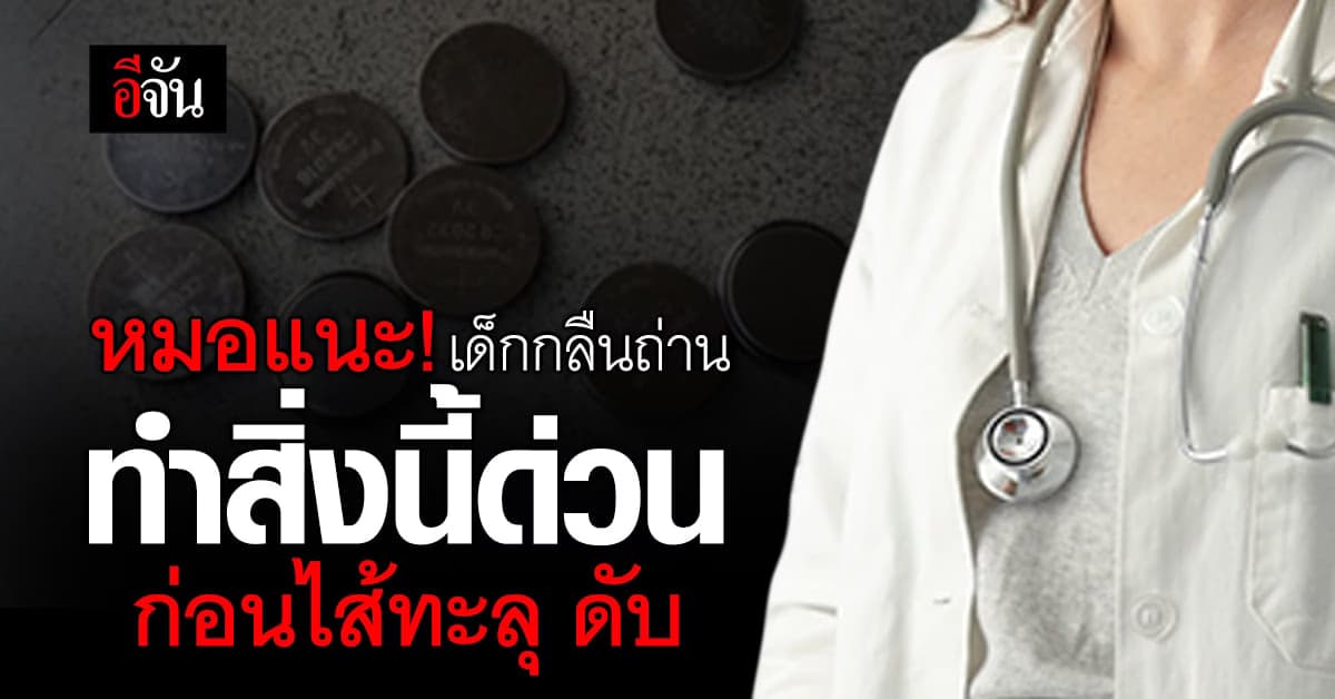 หมอแนะ! เด็กกลืนถ่านกระดุม ทำสิ่งนี้ด่วน ก่อนลำไส้ทะลุดับ