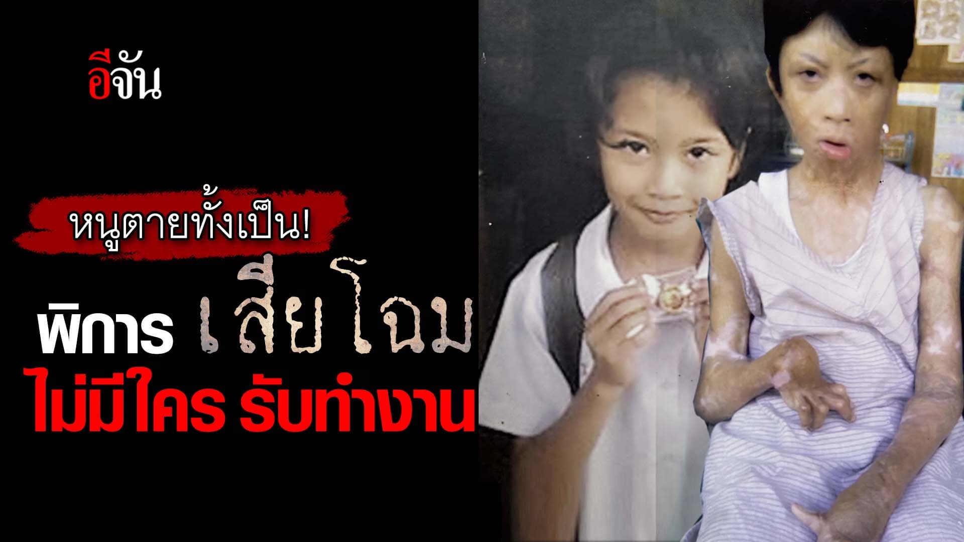 🎬 หนูตายทั้งเป็น! พิการ เสียโฉม ไม่มีใคร รับทำงาน