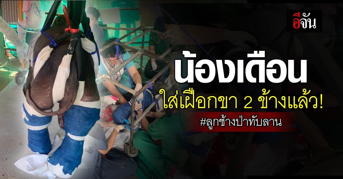 ทีมสัตวแพทย์ ใส่เฝือกให้ “น้องเดือน” ลูกช้างป่าพลัดหลง