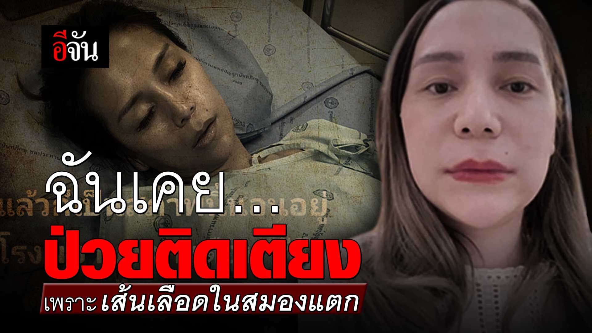 🎬 ฉันเคยป่วยติดเตียง เพราะเส้นเลือดในสมองแตก