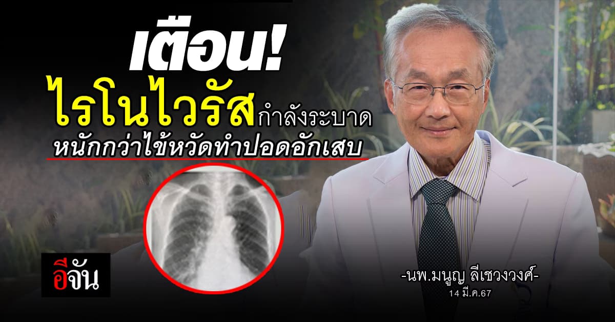 เตือน! ไรโนไวรัสกำลังระบาด หนักกว่าไข้หวัดทำปอดอักเสบ