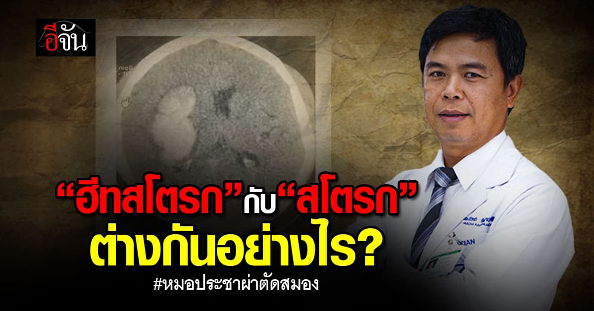 “ฮีทสโตรก” กับ “สโตรก” ต่างกันอย่างไร? ทั้งที่ทำให้สมองขาดเลือดได้เหมือนกัน