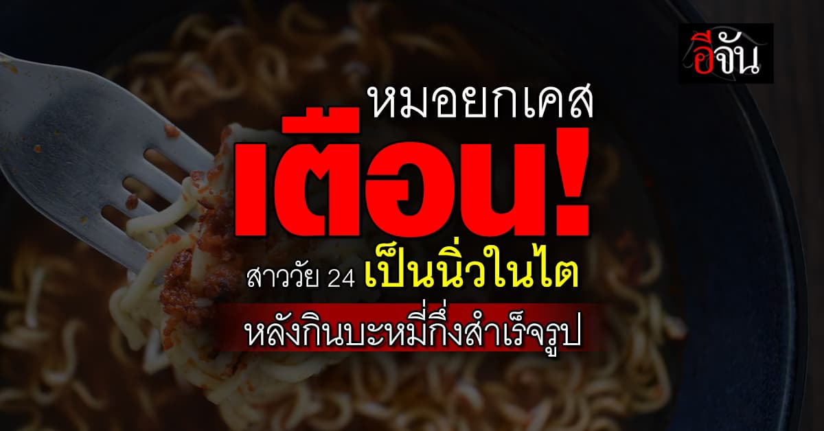 หมอยกเคสเตือน! สาววัย 24 ปี เป็น “นิ่วในไต” เพราะกินบะหมี่กึ่งสำเร็จรูปยี่ห้อดัง