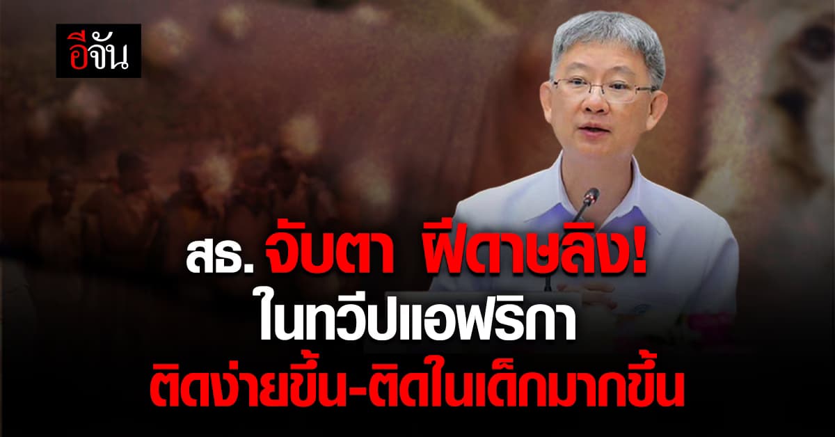 สธ.จับตา ฝีดาษลิง! ในทวีปแอฟริกา ติดง่ายขึ้น-ติดในเด็กมากขึ้น