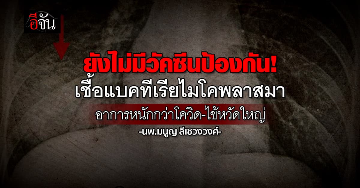 หมอมนูญ ยกเคสผู้ป่วยวัย 29 ติดเชื้อแบคทีเรียไมโคพลาสมา อาการหนักกว่าโควิด