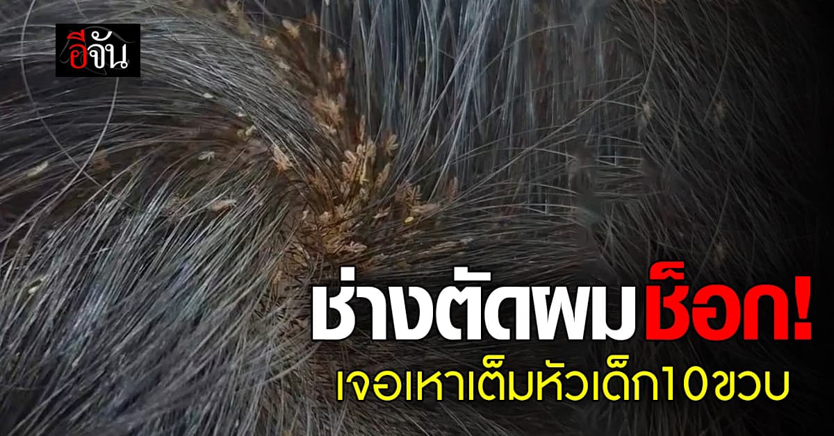 เห็นแล้วสงสาร! ช่างตัดผมเล่านาที กำจัดเหาบนหัวให้เด็ก 10 ขวบ