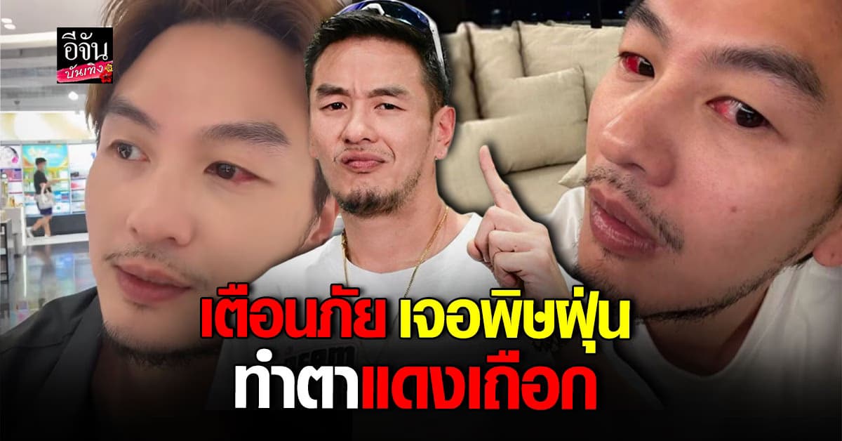 อันตรายใกล้ตัว! บีม ศรัณยู เตือน พิษฝุ่น PM 2.5 ทำตาอักเสบแดงเถือก