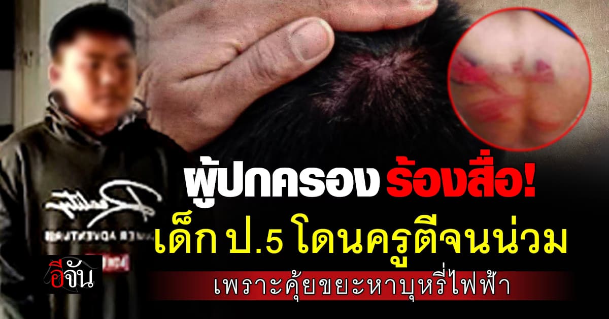 ผู้ปกครอง ร้องสื่อ! เด็ก ป.5 โดนครูตีทำโทษจนน่วม เพราะคุ้ยขยะหาบุหรี่ไฟฟ้า